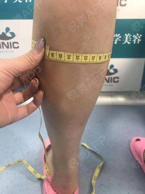 太阳成tyc7111cc-广西贺州平桂区水果办抓好冬季水果质量安全监督工作(图2) 太阳成集团tyc7111cc