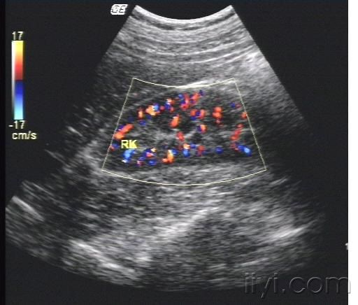 太阳成tyc7111cc|什么是洋辣子?被洋辣子蛰后刺痛烧灼怎么办?(图1) 太阳成tyc7111